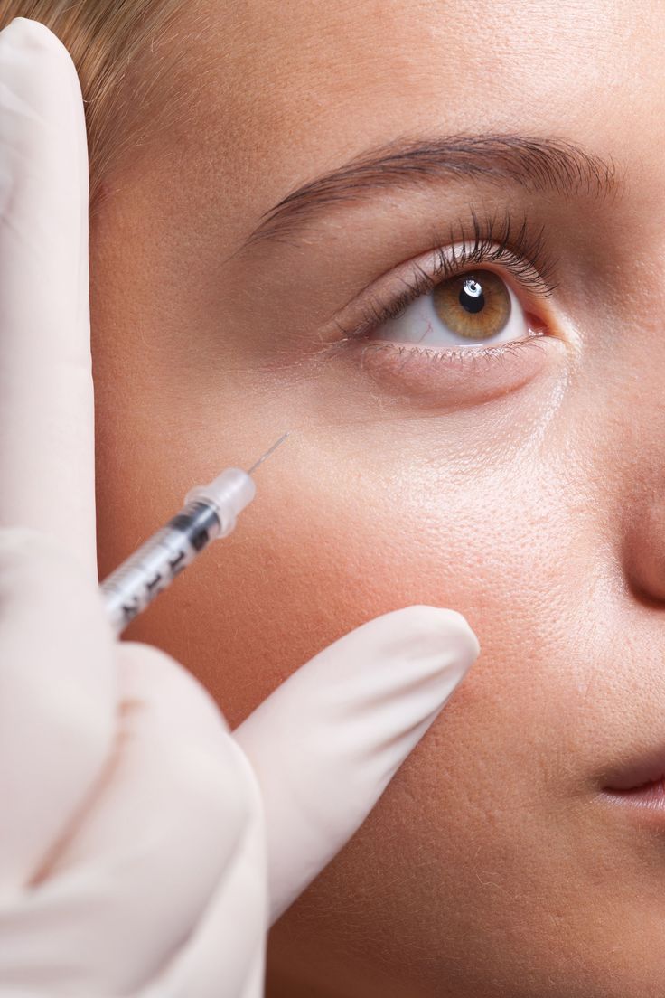 An image of a woman getting Dermal Fillers in her cheek